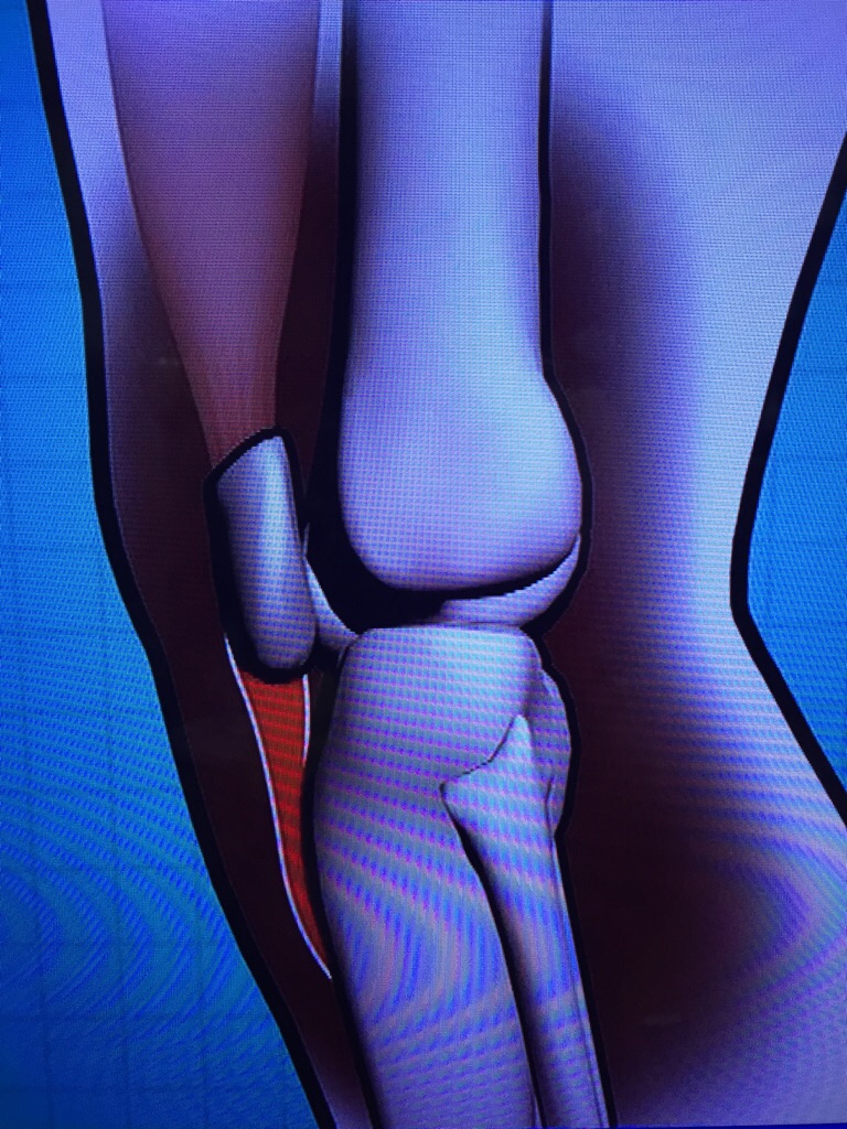 膝蓋腱